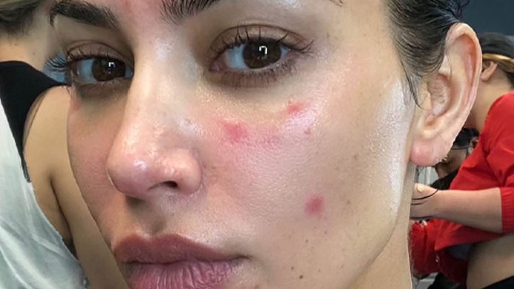 Kim Kardashian, de 42 años, reveló su lucha secreta contra el acné adulto cuando tenía 40 años, que oculta "muy bien" bajo mucho maquillaje mientras entrega SKKN