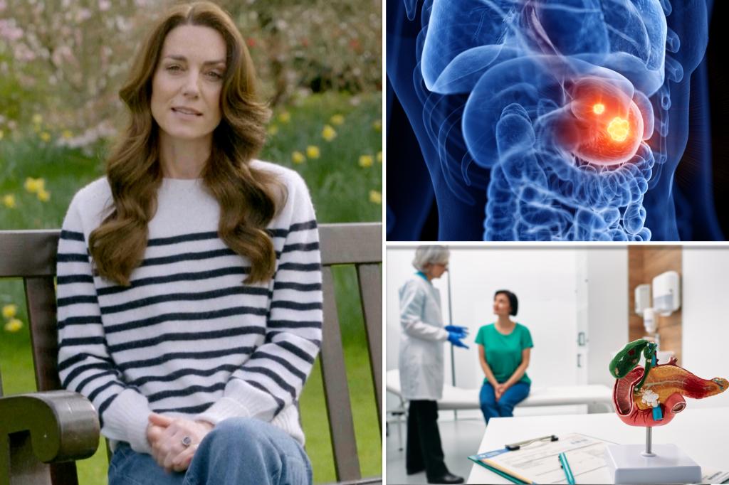 El diagnóstico de Kate Middleton llega en medio de una "epidemia" de cáncer temprano