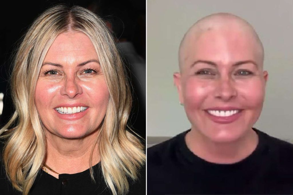 Nicole Eggert se afeita la cabeza tras ser diagnosticada con cáncer de mama